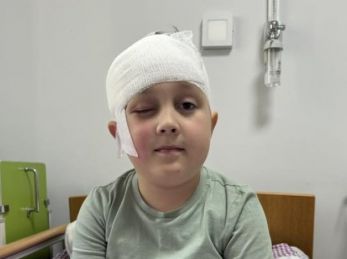 У Львові 8-річному хлопчику видалили складну пухлину, яка впливала на зір
