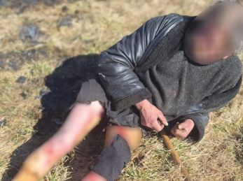 У Львові внаслідок важких травм через підпал трави за один день померли троє людей